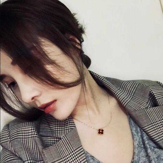 上海藝星醫(yī)療美容醫(yī)院做鼻綜合手術(shù)后的最終效果