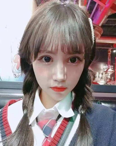 成都美立方（原華博）醫(yī)療美容醫(yī)院做眼部修復(fù)手術(shù)后的三個(gè)月